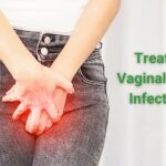 Can I treat a yeast infection myself?