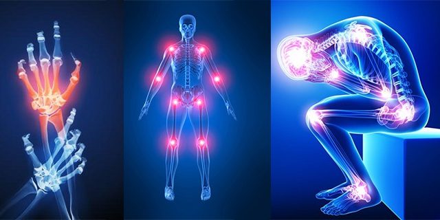 Understanding Pregabalin mg for Chronic Pain Management