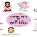 The Symptoms of Hyperprolactinemia and Their Management