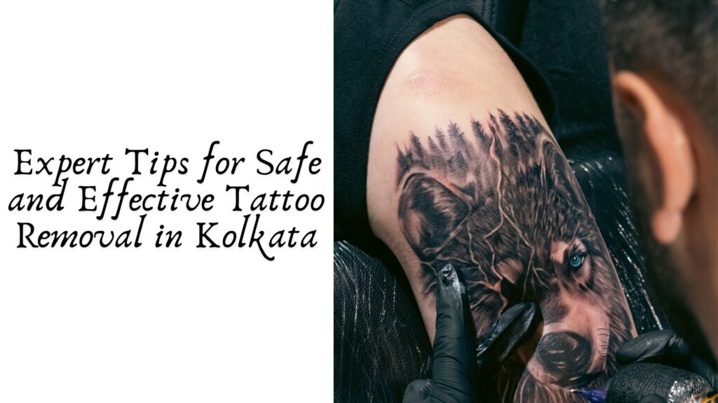 Expert Tips for Safe and Effective Tattoo Removal in Kolkata